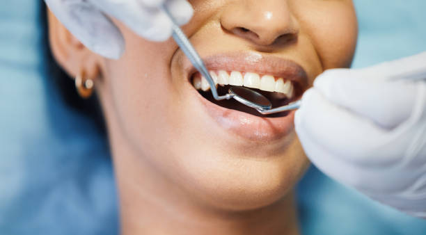 Best Emergency Tooth Extraction in St James, MN